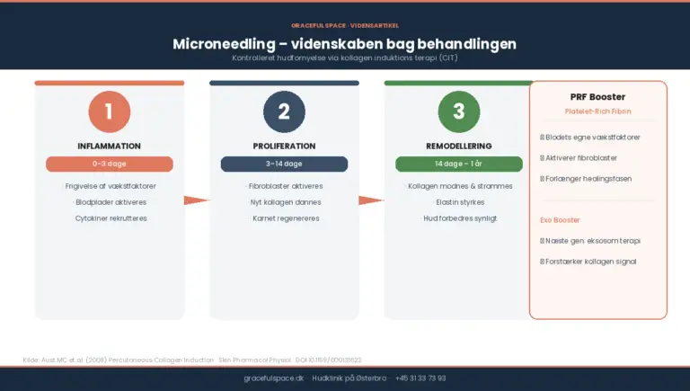 Infografik: microneedling og kollagen-induktionens helingsfaser