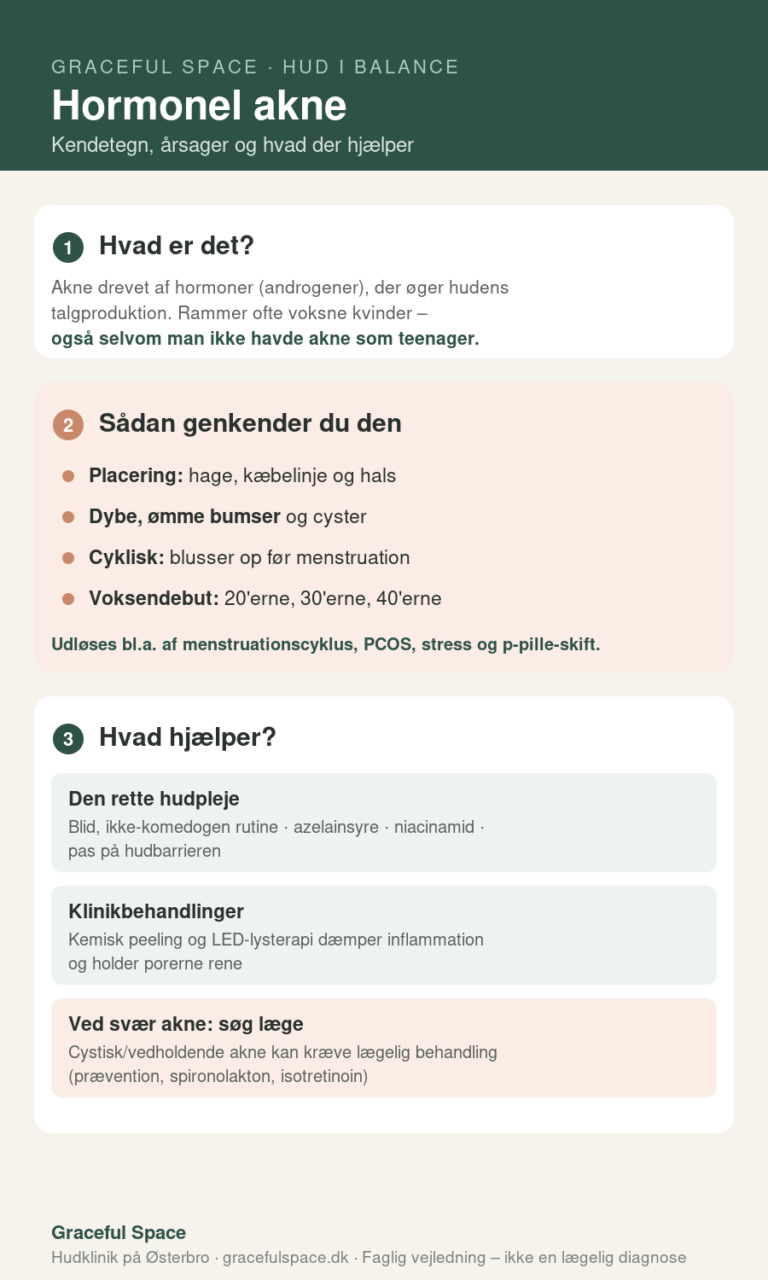 Infografik om hormonel akne – kendetegn, årsager og behandling
